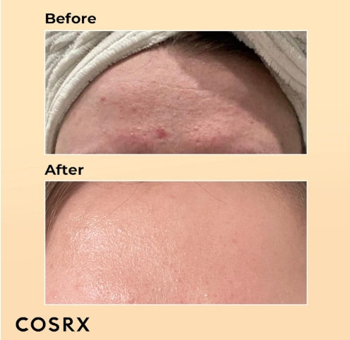 COSRX Snail Mucin 96% Power Repairing Essence 100ml, Hydrating Serum for Face with Snail Secretion Filtrate for Dull Skin & Fine Lines, Korean Skincare